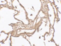 Invitrogen MMP9 Polyclonal Antibody 100 &mu;g; Unconjugated:Antibodies,
