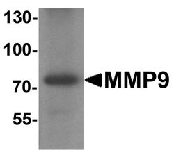 Invitrogen MMP9 Polyclonal Antibody 100 &mu;g; Unconjugated:Antibodies,