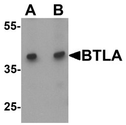 Invitrogen CD272 (BTLA) Polyclonal Antibody 100 &mu;g; Unconjugated:Antibodies,