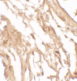 Invitrogen IL-37 Polyclonal Antibody 100 &mu;g; Unconjugated:Antibodies,