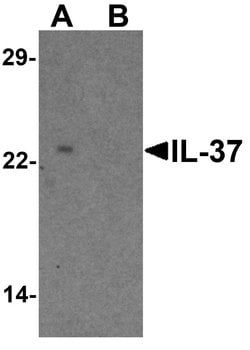 Invitrogen IL-37 Polyclonal Antibody 100 &mu;g; Unconjugated:Antibodies,