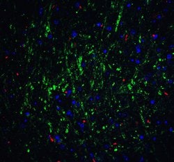 Invitrogen RPSA Polyclonal Antibody 100 &mu;g; Unconjugated:Antibodies,