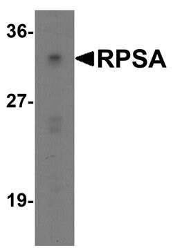 Invitrogen RPSA Polyclonal Antibody 100 &mu;g; Unconjugated:Antibodies,