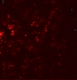 Invitrogen CCR7 Polyclonal Antibody 100 &mu;g | Buy Online | Invitrogen&trade; | Fisher Scientific