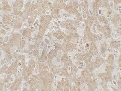 Invitrogen CCR7 Polyclonal Antibody 100 &mu;g | Buy Online | Invitrogen&trade; | Fisher Scientific