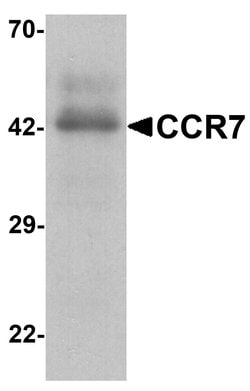 Invitrogen CCR7 Polyclonal Antibody 100 &mu;g | Buy Online | Invitrogen&trade; | Fisher Scientific