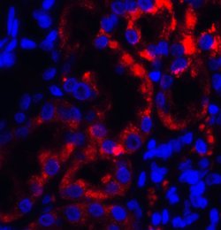 Invitrogen TRPV4 Polyclonal Antibody 100 &mu;g; Unconjugated:Antibodies,