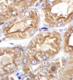 Invitrogen TRPV4 Polyclonal Antibody 100 &mu;g; Unconjugated:Antibodies,