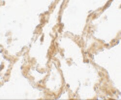 Invitrogen TRPV4 Polyclonal Antibody 100 &mu;g; Unconjugated:Antibodies,