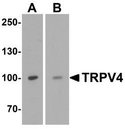 Invitrogen TRPV4 Polyclonal Antibody 100 &mu;g; Unconjugated:Antibodies,