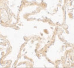 Invitrogen SUZ12 Polyclonal Antibody 100 &mu;g | Buy Online | Invitrogen&trade; | Fisher Scientific