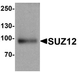 Invitrogen SUZ12 Polyclonal Antibody 100 &mu;g | Buy Online | Invitrogen&trade; | Fisher Scientific