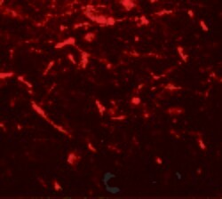 FMRP Polyclonal Antibody:Antibodies, Polyclonal