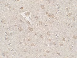 FMRP Polyclonal Antibody:Antibodies, Polyclonal