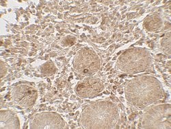 Invitrogen LAMTOR1 Polyclonal Antibody 100 &mu;g; Unconjugated:Antibodies,