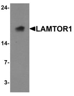 Invitrogen LAMTOR1 Polyclonal Antibody 100 &mu;g; Unconjugated:Antibodies,