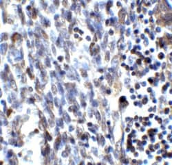 Invitrogen SMURF2 Polyclonal Antibody 100 &mu;g; Unconjugated:Antibodies,