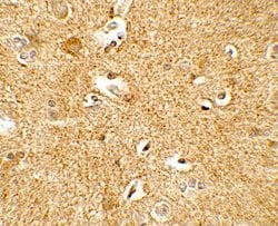 Invitrogen CRF Polyclonal Antibody 100 &mu;g; Unconjugated:Antibodies,