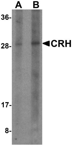 Invitrogen CRF Polyclonal Antibody 100 &mu;g; Unconjugated:Antibodies,