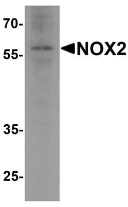 Invitrogen NOX2 Polyclonal Antibody 100 &mu;g; Unconjugated:Antibodies,
