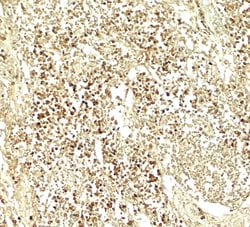 Invitrogen E2F3 Polyclonal Antibody 100 &mu;g | Buy Online | Invitrogen&trade; | Fisher Scientific