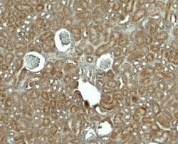 RhoG Polyclonal Antibody:Antibodies, Polyclonal