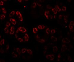 Invitrogen SKIV2L Polyclonal Antibody 100 &mu;g; Unconjugated:Antibodies,