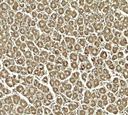 Invitrogen SKIV2L Polyclonal Antibody 100 &mu;g; Unconjugated:Antibodies,