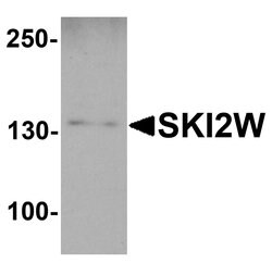 Invitrogen SKIV2L Polyclonal Antibody 100 &mu;g; Unconjugated:Antibodies,