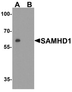 Invitrogen SAMHD1 Polyclonal Antibody 100 &mu;g; Unconjugated:Antibodies,