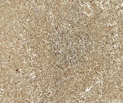 ATG4B Polyclonal Antibody:Antibodies, Polyclonal