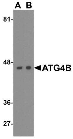 ATG4B Polyclonal Antibody:Antibodies, Polyclonal