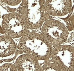 ATG4D Polyclonal Antibody:Antibodies, Polyclonal
