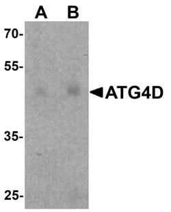 ATG4D Polyclonal Antibody:Antibodies, Polyclonal