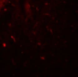 Invitrogen MALT1 Polyclonal Antibody 100 &mu;g | Buy Online | Invitrogen&trade; | Fisher Scientific