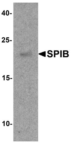 Invitrogen SPIB Polyclonal Antibody 100 μg; Unconjugated:Antibodies,