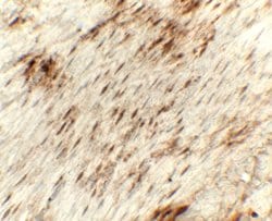 Invitrogen Golgin-97 Polyclonal Antibody 100 &mu;g; Unconjugated:Antibodies,