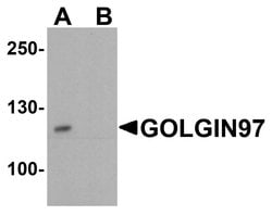 Invitrogen Golgin-97 Polyclonal Antibody 100 &mu;g; Unconjugated:Antibodies,