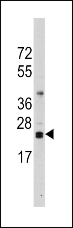 Invitrogen CD3z Polyclonal Antibody 400 μL; Unconjugated:Antibodies,