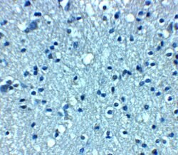 VTI1A Polyclonal Antibody:Antibodies, Polyclonal