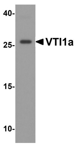 VTI1A Polyclonal Antibody:Antibodies, Polyclonal