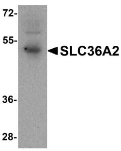 Invitrogen SLC36A2 Polyclonal Antibody 100 &mu;g; Unconjugated:Antibodies,
