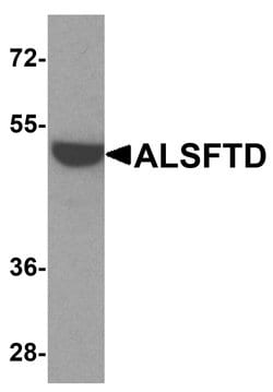 Invitrogen C9orf72 Polyclonal Antibody 100 &mu;g; Unconjugated:Antibodies,