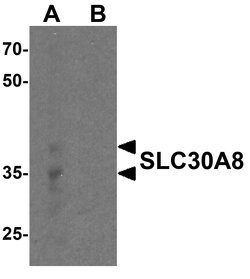Invitrogen SLC30A8 Polyclonal Antibody 100 &mu;g; Unconjugated:Antibodies,