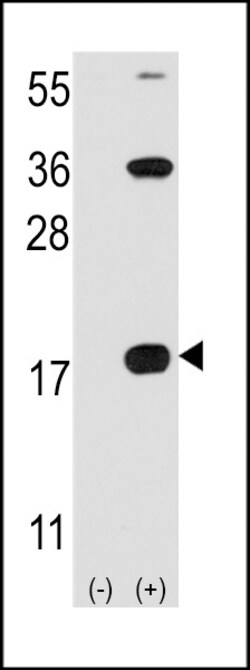 Invitrogen CD3z Polyclonal Antibody 400 μL; Unconjugated:Antibodies,