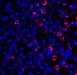 CD28 Polyclonal Antibody:Antibodies, Polyclonal