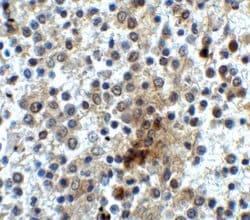 CD28 Polyclonal Antibody:Antibodies, Polyclonal