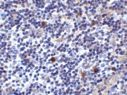 Invitrogen CD275 (B7-H2) Polyclonal Antibody 100 &mu;g; Unconjugated:Antibodies,