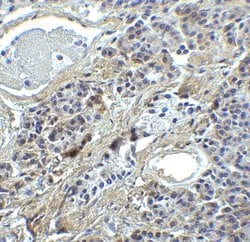 Invitrogen IRF7 Polyclonal Antibody 100 &mu;g; Unconjugated:Antibodies,