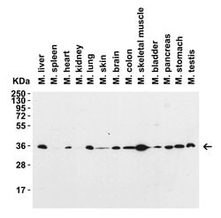 Invitrogen SIGLEC15 Polyclonal Antibody 100 &mu;g; Unconjugated:Antibodies,